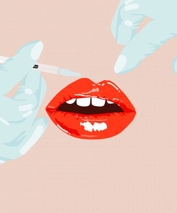 art illustration of a mouth getting fillers