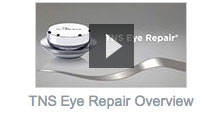 TNS Eye Repair Overview