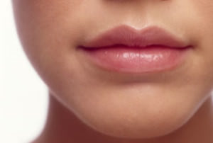 Juvederm Lips