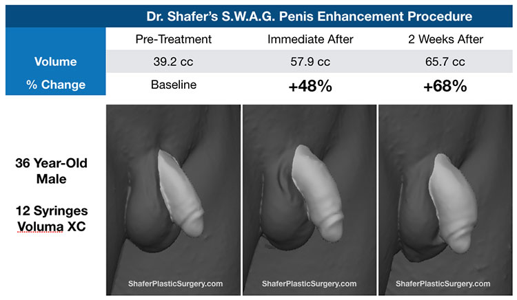 SWAG Penis Enhancement illustration