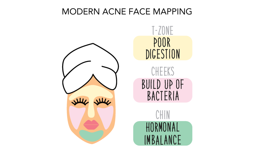 Modern Acne Face Mapping Graphic