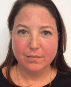 1729196940-vbeam-939d