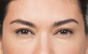 1729197365-botox-3377