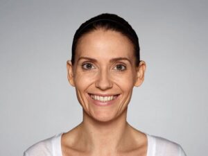 1729199316-restylane-defyne-7ff8