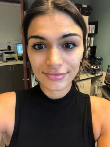 1729199469-hydrafacial-4f9d