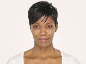 1729199831-radiesse-15e9