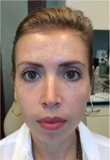 1729199929-clear-and-brilliant-c371 1729199929-clear-and-brilliant-c371